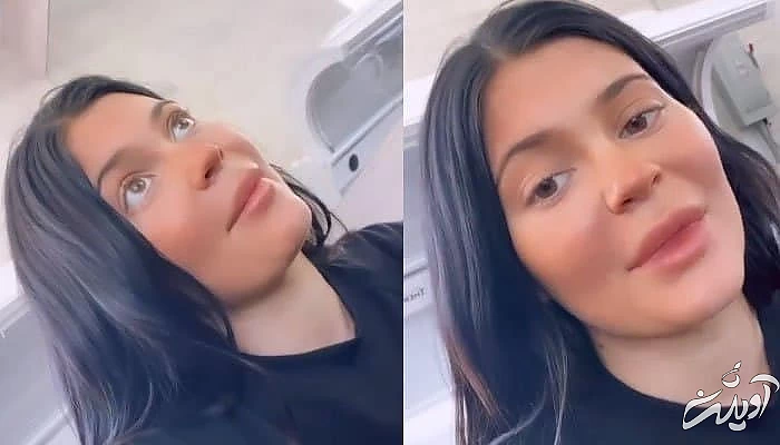 کایلی جنر بعد زایمان